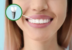 The Different Types Of Dental Implants